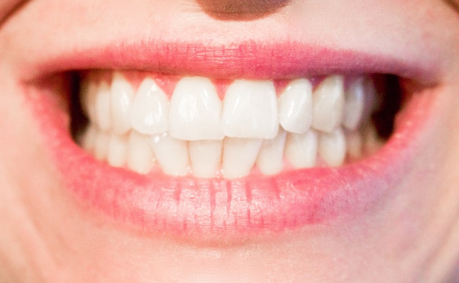 How To Whiten Teeth in Paint.net